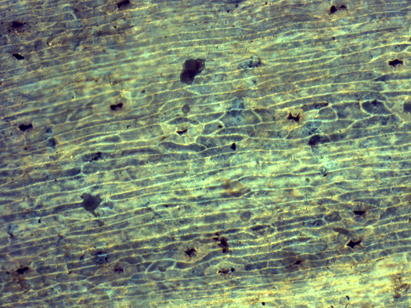 Microscopic image of plant tissue: tightly packed, mostly elongated cells