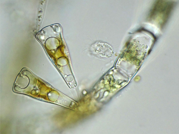 Seen under a microscope, two cup-shaped, transparent cells attached by legs to a thread-like structure