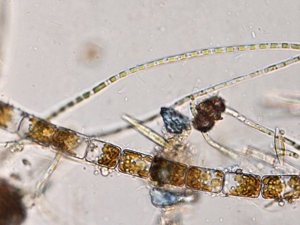 Seen under a microscope, filamentous brown-green structures of varying thickness, composed of interconnected cells