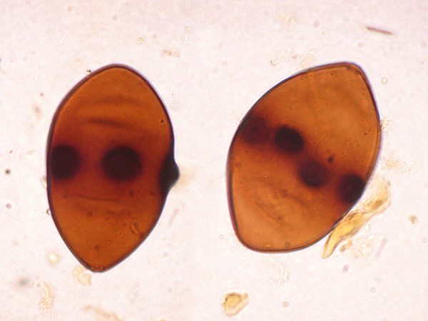 Microscopic image of two dark brown, slightly transparent rugby ball-shaped objects against a light background