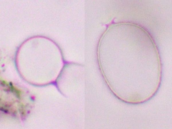 Seen under a microscope, oval, smooth, transparent structures on a light pink background